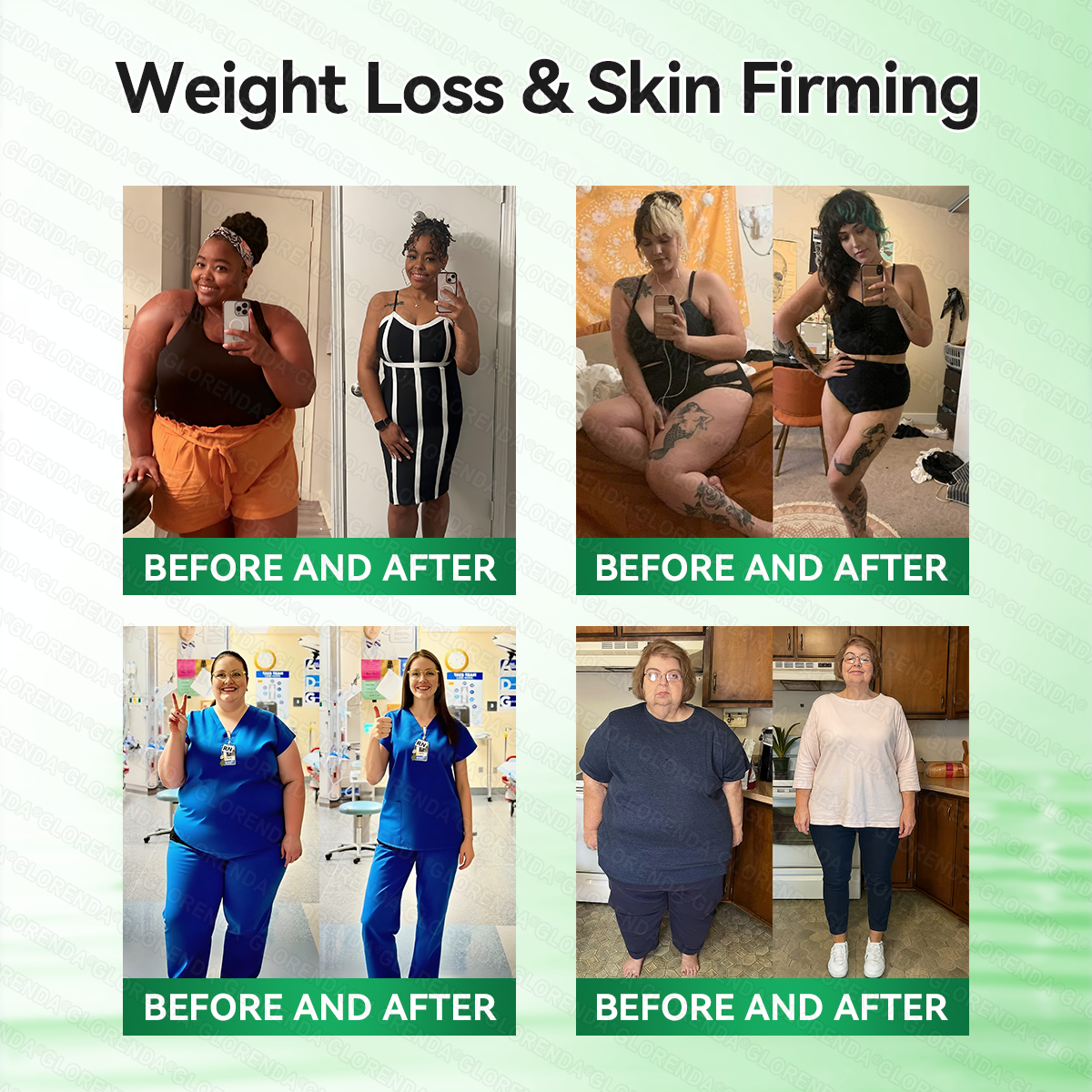 𝑶𝒇𝒇𝒊𝒄𝒊𝒂𝒍 𝑺𝒕𝒐𝒓𝒆  | 𝐆𝑳𝑶𝗥𝗘𝗡𝘿𝘼® 𝙈𝒐𝒓𝒊𝒏𝒈𝗮 · 𝗕𝗲𝗿𝗯𝐞𝐫𝐢𝐧𝙚 × 𝙉𝑨𝑫+ 𝟏𝟎-𝙞𝙣-𝟏 𝘼𝒅𝒗𝒂𝒏𝒄𝒆𝐝 𝐍𝐚𝐧𝙤 𝙈𝙞𝙘𝙧𝙤𝙣𝒆𝒆𝒅𝒍𝐞 𝐏𝐚𝐭𝙘𝙝(𝐉𝐮𝐬𝐭 𝐨𝐧𝐜𝐞 𝐚 𝐝𝐚𝐲, 𝐯𝐢𝐬𝐢𝐛𝐥𝐞 𝐜𝐡𝐚𝐧𝐠𝐞𝐬 𝐢𝐧 𝟕 𝐝𝐚𝐲𝐬）